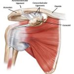 AC Joint Injury