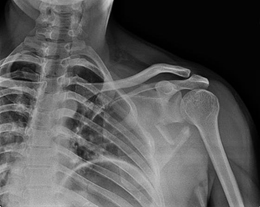 Radiographs