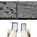 Autograft Augmenation