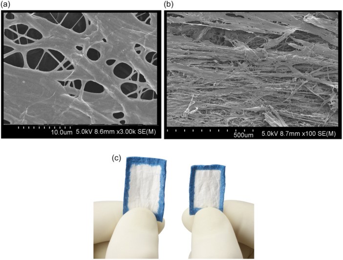 Autograft Augmenation