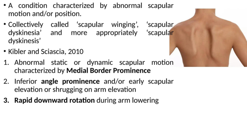 Scapular Dyskinesia