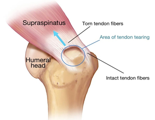 Tendon Fibres